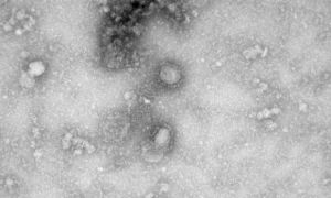 Australia tái tạo thành công virus corona trong phòng thí nghiệm