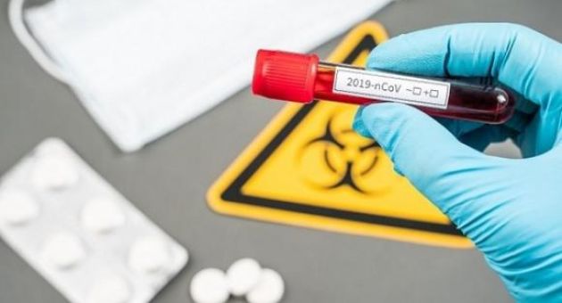 Cộng hòa Séc xác nhận 3 trường hợp nhiễm virus SARS-CoV-2 đầu tiên