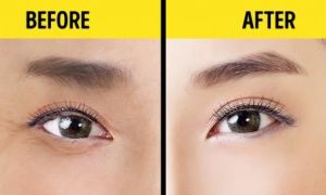 Chống lão hóa mắt với bài tập 1 phút của người Nhật