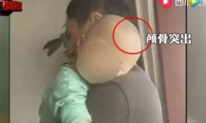 Trung Quốc: Xuất hiện loại “sữa bột“ trẻ em uống vào bị bệnh “đầu to mình nhỏ”