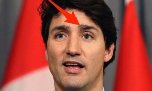 Chuyện thật như đùa: Đẹp trai như thủ tướng Canada mà cũng có ngày dùng lông...