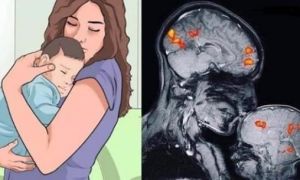 Ảnh chụp MRI cho thấy: Trẻ được vỗ về, ôm ấp từ nhỏ sẽ có nền tảng hạnh phúc...