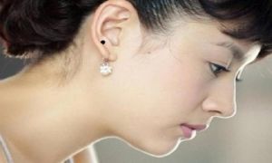 5 nốt ruồi bạc tỉ giàu nứt đố đổ vách chị em đừng vội xóa đi