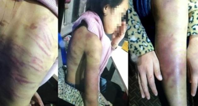 Bé gái 12 tuổi bị bạo hành, xâm hại tình dục: Khởi tố mẹ và người tình