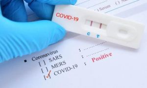 Phát hiện cách tiêu diệt 99,9% SARS-CoV-2 trong phổi