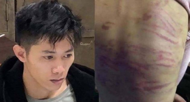 Đôi nhân tình lĩnh 22 năm tù vì hành hạ, xâm hại bé gái 12 tuổi