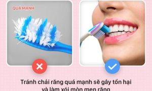 4 dấu hiệu cảnh báo bạn đang đánh răng quá kỹ và cách khắc phục để giữ răng khỏe