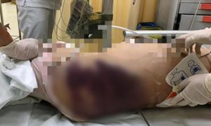Bé 8 tuổi tử vong nghi do