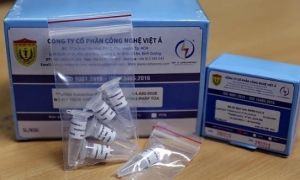 Bình Thuận chi gần trăm tỷ đồng mua kit Việt Á bằng hình thức chỉ định thầu