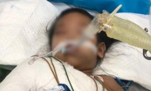 Bé 3 tuổi ở Hà Nội bị ghim đinh vào đầu vẫn chưa thể phẫu thuật