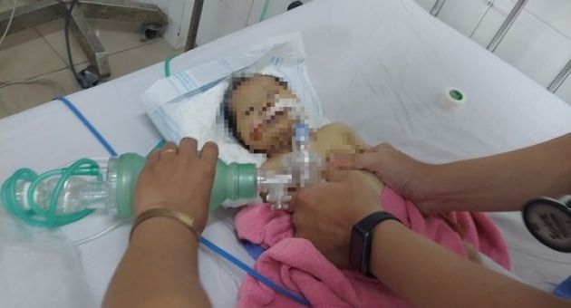 Sức khỏe cháu bé bị bỏ rơi giữa rừng ở Quảng Nam chuyển biến xấu