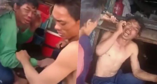 Ngư dân bị hành hạ dã man trên biển thương tích 48%