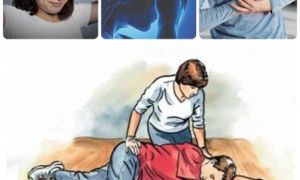 4 dấu hiệu cảnh báo cơn đột quỵ trước 1 tuần, 30 ngày đến vài tháng