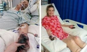 Người phụ nữ phải bỏ 2 chân và ngón tay vì căn bệnh triệu chứng giống cúm...