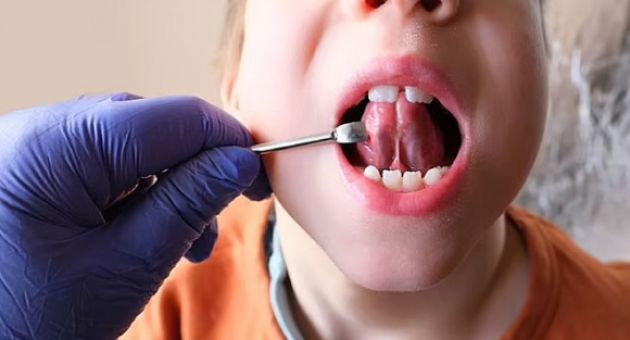 Nhiều bác sĩ Mỹ chỉ định cắt thắng lưỡi trẻ sơ sinh bừa bãi