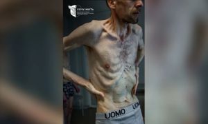 Ukraine công bố ảnh tù binh 'da bọc xương' khi được Nga trao trả