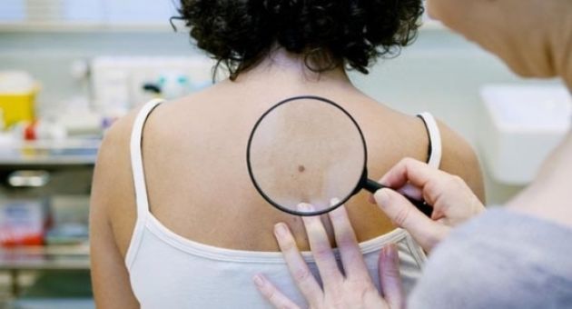 Những dấu hiệu cảnh báo ung thư sớm, bác sĩ hướng dẫn cách tự kiểm tra tại nhà