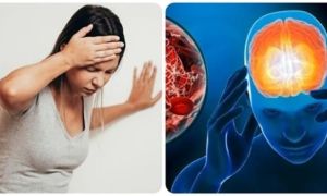 4 dấu hiệu cảnh báo cơn đột quỵ cần xử trí nhanh