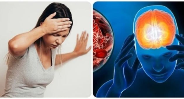 4 dấu hiệu cảnh báo cơn đột quỵ cần xử trí nhanh