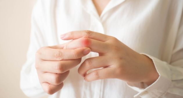 Stress làm tăng nguy cơ mắc bệnh gout thế nào