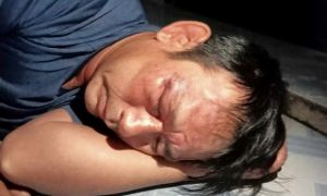 Làm thơ trên Facebook, người đàn ông bị 8 người lạ đánh nhập viện