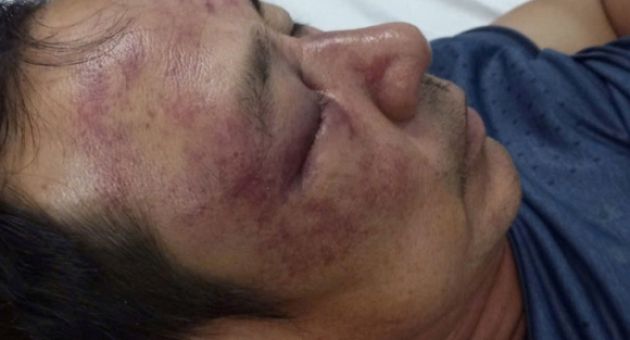 Nhóm đánh người đăng thơ lên Facebook khai cay cú vì nạn nhân châm biếm giải...