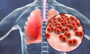 Bệnh nhiều người Việt xem nhẹ, âm thầm khiến hàng triệu người ra đi