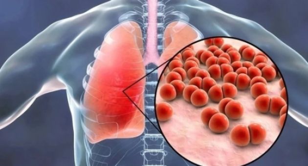 Bệnh nhiều người Việt xem nhẹ, âm thầm khiến hàng triệu người ra đi