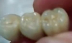 Khách TQ hoảng hốt khi phát hiện răng giả trong xúc xích, dim sum